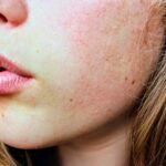 Close-up van een gezicht met droge huid