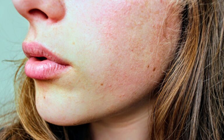 Close-up van een gezicht met droge huid